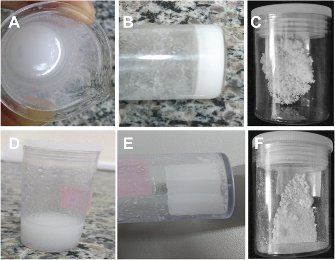 Preparation and characterization of boron-based bioglass by sol−gel process  | SpringerLink