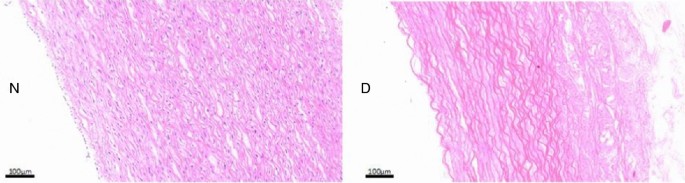 DSC and histological analysis of decellularized porcine biograft |  SpringerLink