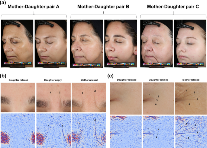 Facial Expression Wrinkles and Their Relaxation by a Synthetic