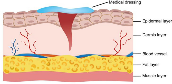 bpc 157 for nerve damage Regeneration or Risk? A Narrative Review of BPC-157 for Musculoskeletal  Healing | Current Reviews in Musculoskeletal Medicine