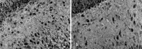 Hippocampal Neurodegeneration In Experimental Autoimmune Encephalomyelitis Eae Potential Role Of Inflammation Activated Myeloperoxidase Springerlink
