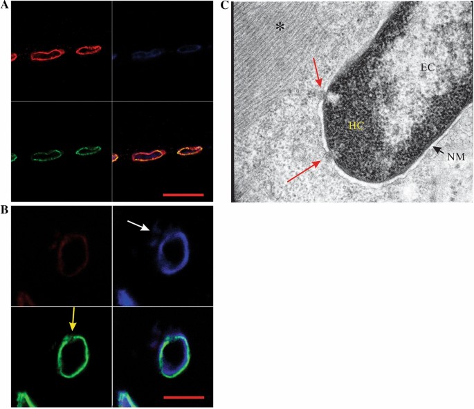 Evidence Of Synergism Among Three Genetic Variants In A Patient With Lmna Related Lipodystrophy And Amyotrophic Lateral Sclerosis Leading To A Remarkable Nuclear Phenotype Springerlink