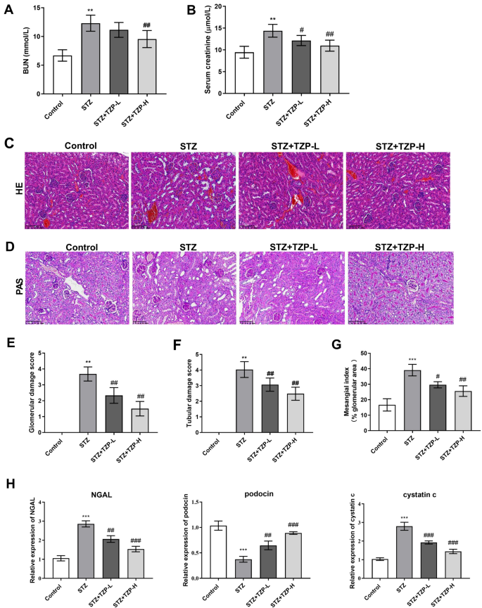 Tirzepatide alleviates oxidative stress and inflammation in diabetic ...