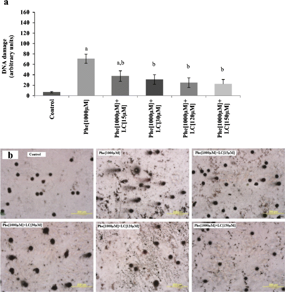 Protective effect of L-carnitine on Phenylalanine-induced DNA damage |  Metabolic Brain Disease | Springer Nature Link