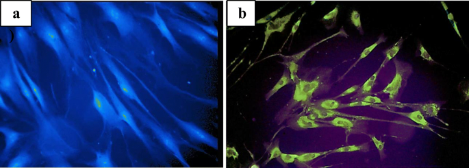 Rapid Diagnosis of 83 Patients with Niemann Pick Type C Disease and Related  Cholesterol Transport Disorders by Cholestantriol Screening - eBioMedicine