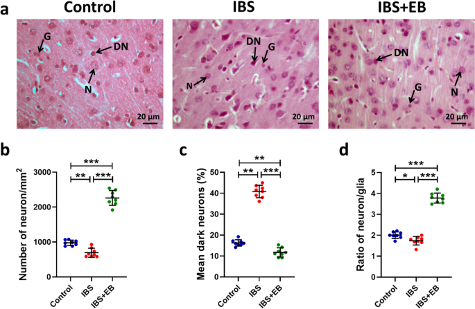 glutathione and ibs Elderberry diet improves gut-brain axis dysfunction, neuroinflammation, and  cognitive impairment in the rat model of irritable bowel syndrome |  Metabolic Brain Disease