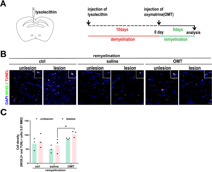 Oxymatrine possibly inhibits differentiation and maturation of ...