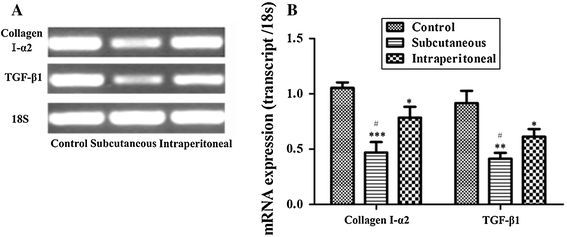 Clodronate liposomes reduce excessive scar formation in a mouse model of  burn injury by reducing collagen deposition and TGF-β1 expression |  SpringerLink