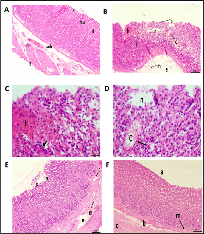 Aloe vera gel confers therapeutic effect by reducing pyroptosis in  ethanol-induced gastric ulcer rat model: Role of NLRP3/GSDMD signaling  pathway | Molecular Biology Reports | Springer Nature Link
