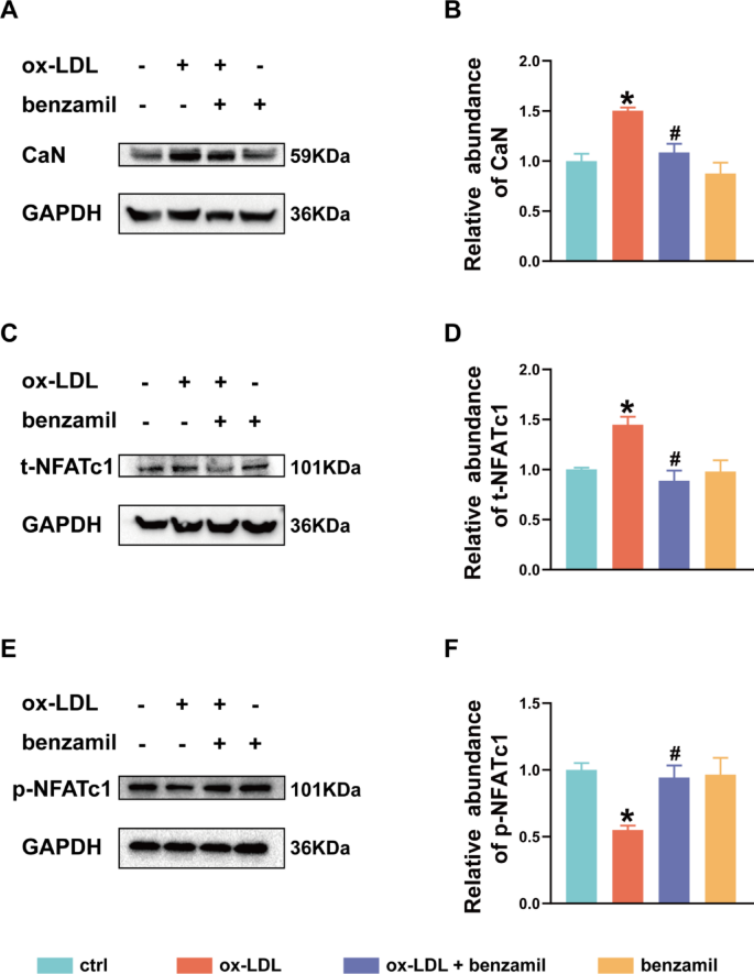 Epithelial sodium channel in dendritic cells participates in high-fat ...