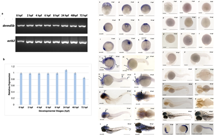 Role of DENN Domain-Containing Protein 5b (dennd5b) during early ...