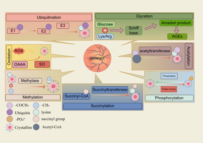 Key post-translational modifications of crystallin: from mechanism to ...