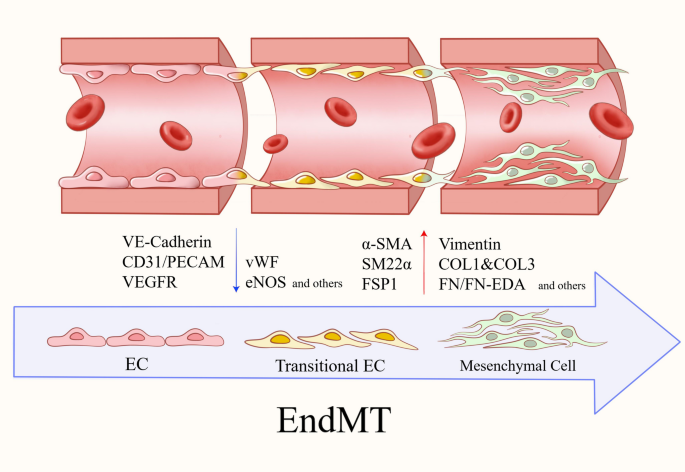 Endothelial-Mesenchymal transition in cerebrovascular diseases ...