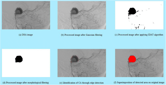 figure 19