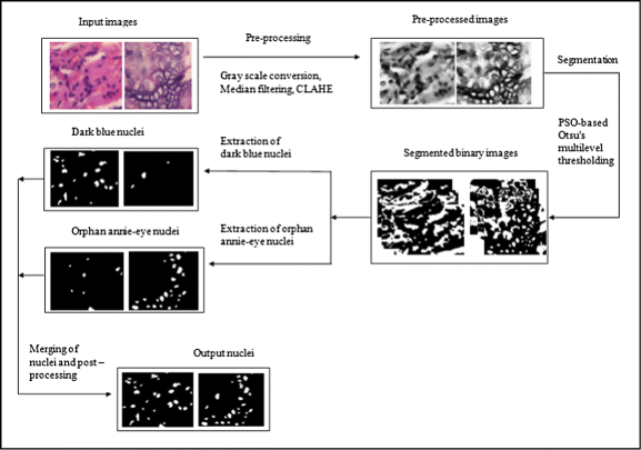 Automatic Classification Of Thyroid Histopathology Images Using Multi Classifier System Springerlink