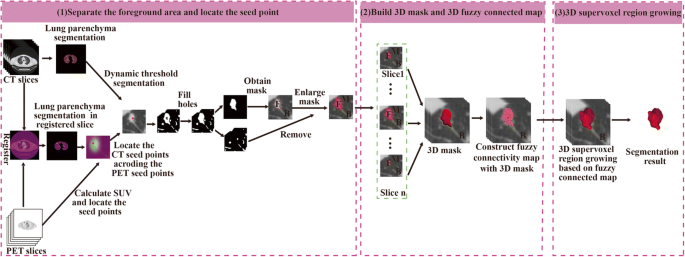 An Improved Supervoxel 3d Region Growing Method Based On Pet Ct Multimodal Data For Segmentation And Reconstruction Of Ggns Springerlink An Improved Supervoxel 3d Region Growing Method Based On Pet Ct Multimodal Data For Segmentation And Reconstruction Of Ggns Springerlink