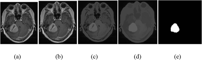 figure 18