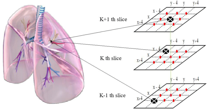 A novel deep learning framework for lung nodule detection in 3d CT images |  SpringerLink