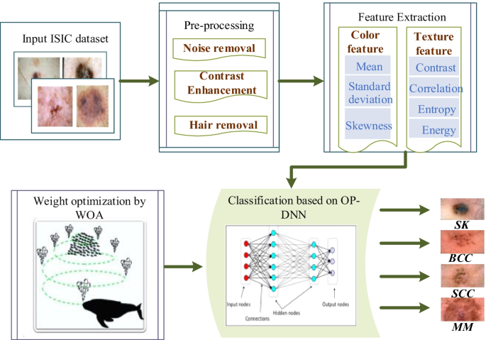 Multi-type skin diseases classification using OP-DNN based feature  extraction approach | SpringerLink