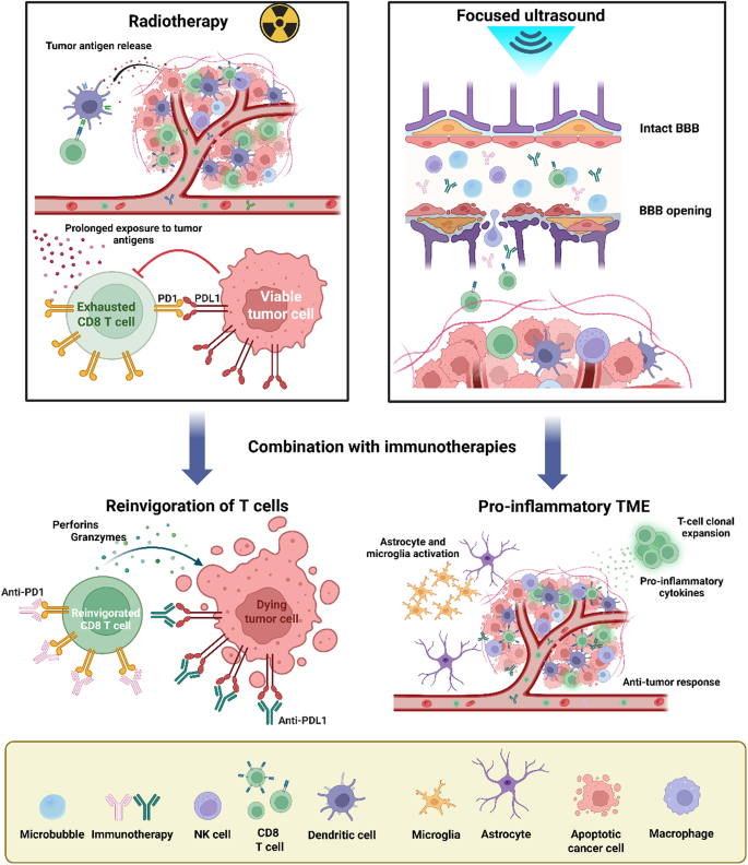 Synergy of radiotherapy, focused ultrasound, and immunotherapy in the ...