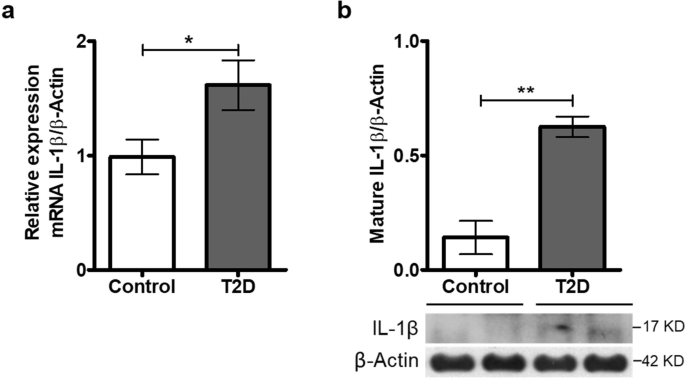 Olfactory Dysfunction In Diabetic Rats Is Associated With Mir 146a Overexpression And Inflammation Springerlink