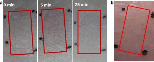 Microneedle-Mediated Delivery of Copper Peptide Through Skin |  Pharmaceutical Research