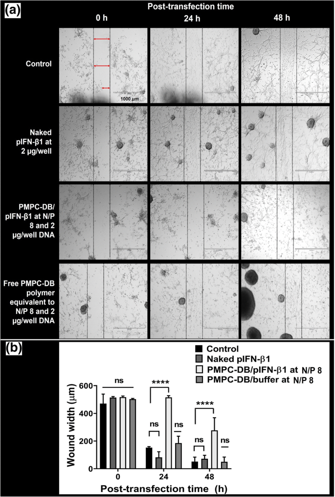 Dna Polyplexes Of A Phosphorylcholine Based Zwitterionic Polymer For Gene Delivery Springerlink