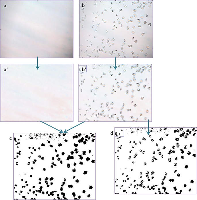 Adaptive Background Correction Of Crystal Image Datasets Towards Automated Process Control Springerlink