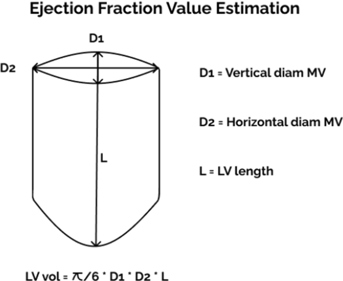 A SIMPLIFIED FORMULA FOR ESTIMATION OF EJECTION FRACTION FROM