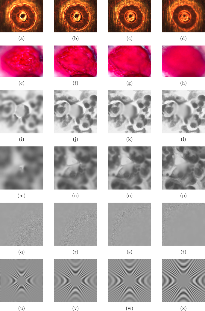 Two-phase deep learning method for image fusion-based extended depth of ...