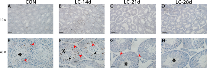 Chronic oral administration of L-carnitine induces testicular injury: in  vivo evidence | International Urology and Nephrology
