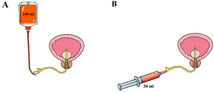 Two different protocols in single, immediate, postoperative ...