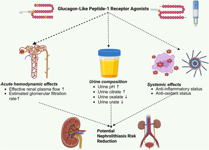 Glucagon-like peptide-1 receptor agonists: an emerging hope against  nephrolithiasis risk reduction via body weight reduction | International  Urology and Nephrology