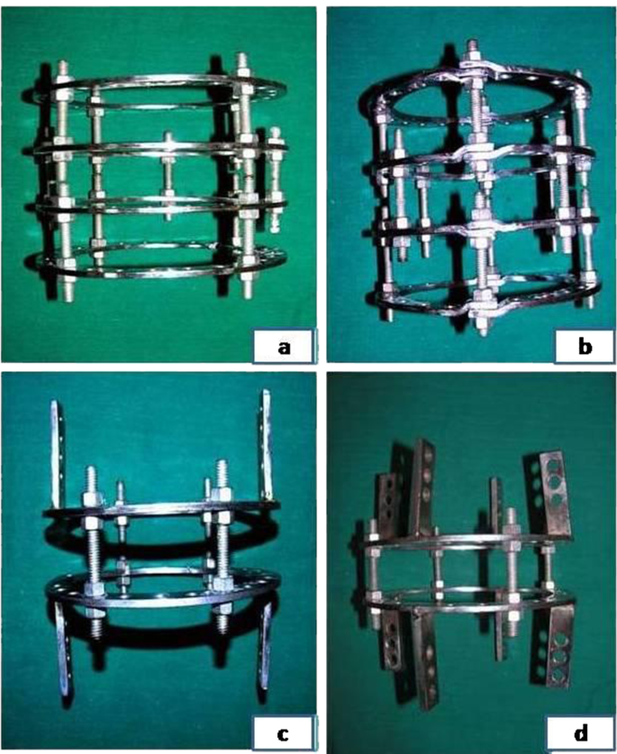 Orthopedic Instruments External Fixator Half Ring Type for Tibia