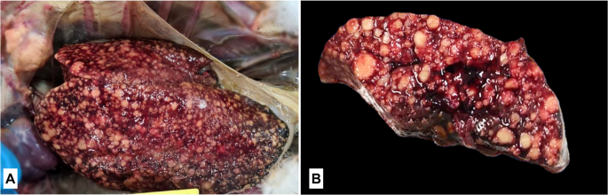 Case report: granulomatous hepatitis due to Mycobacterium avium in an  Atlantic yellow-nosed albatross (Thalassarche chlororhynchos) from Southern  Brazilian coast | Veterinary Research Communications