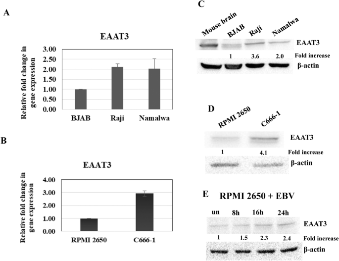 glutathione ebv Epstein–Barr virus infection controls the concentration of the  intracellular antioxidant glutathione by upregulation of the glutamate  transporter EAAT3 in tumor cells | Virus Genes