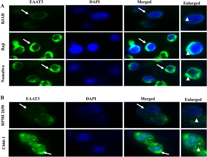 glutathione ebv Epstein–Barr virus infection controls the concentration of the  intracellular antioxidant glutathione by upregulation of the glutamate  transporter EAAT3 in tumor cells | Virus Genes
