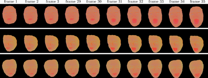 figure 25