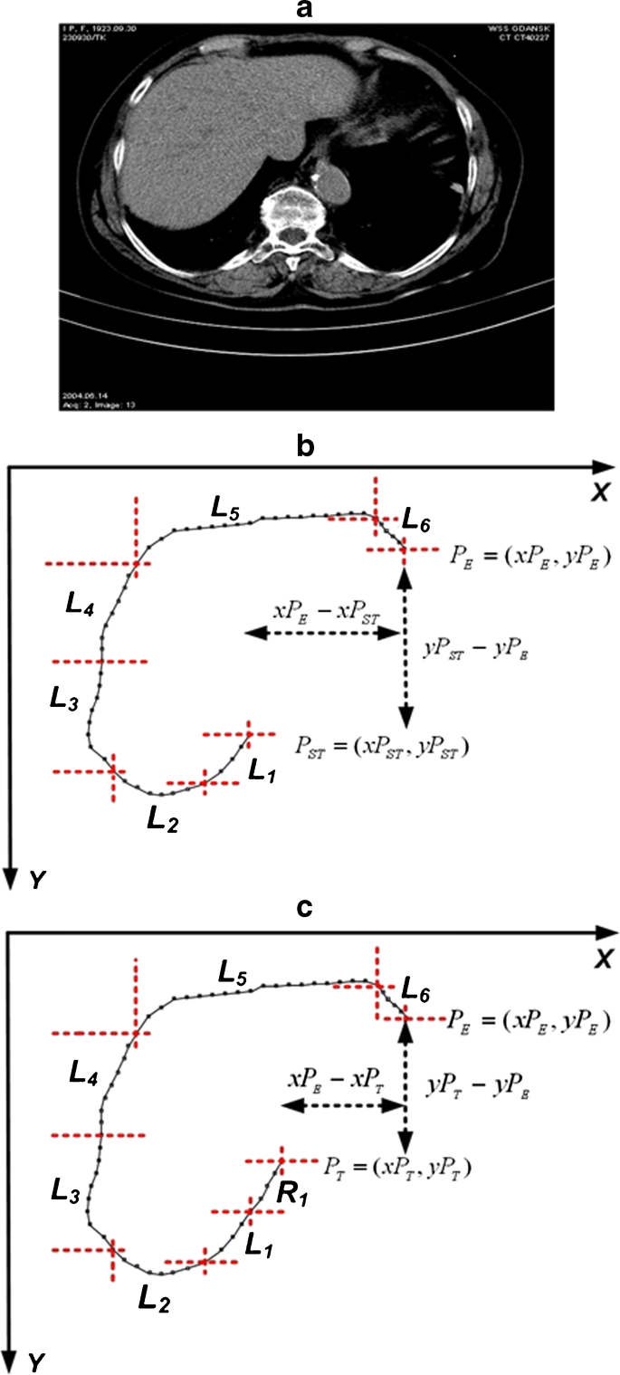 figure 16