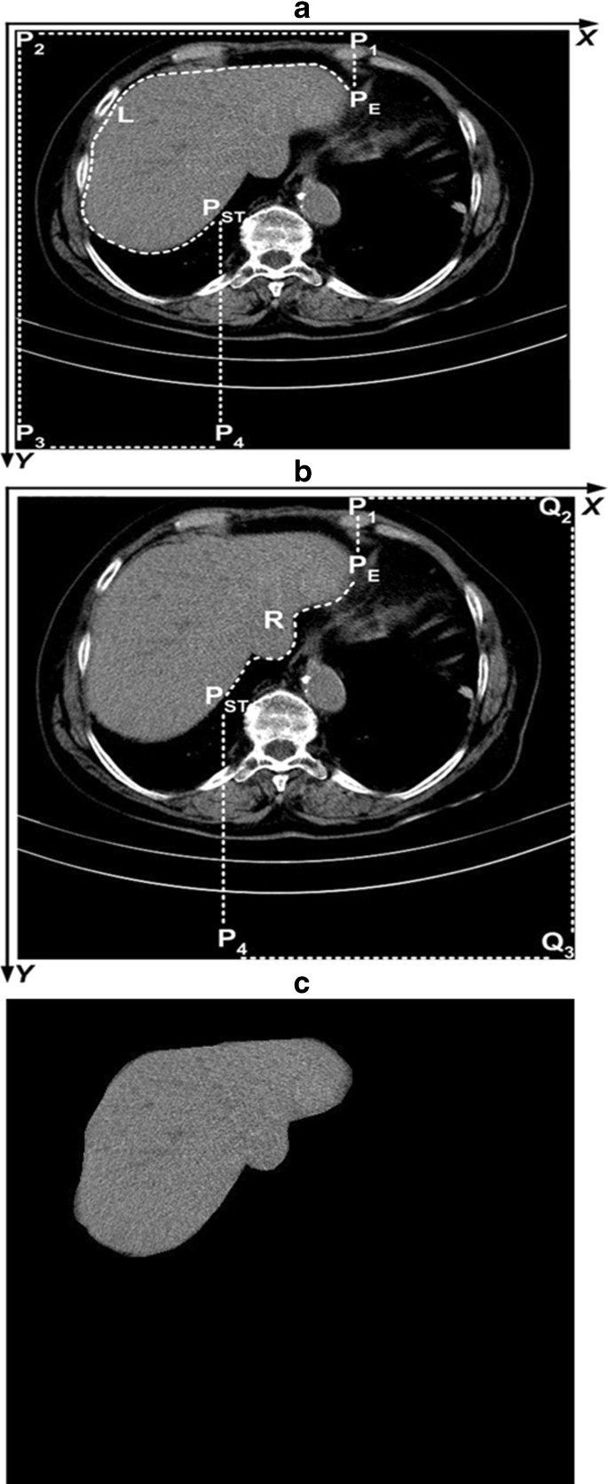 figure 19