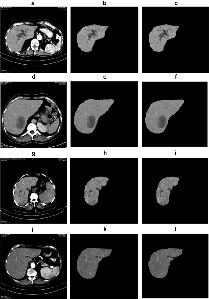 figure 21