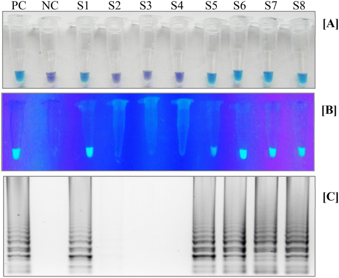 Rapid Visual Detection Of Vibrio Parahaemolyticus In Seafood Samples By Loop Mediated Isothermal Amplification With Hydroxynaphthol Blue Dye Springerlink