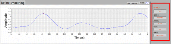 figure 17