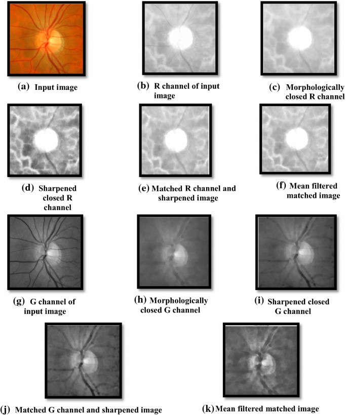 Pre Processing Of Retinal Images For Removal Of Outliers Springerlink