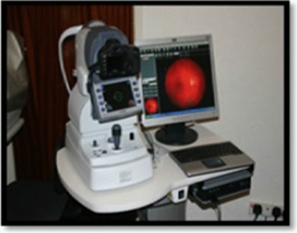 Pre Processing Of Retinal Images For Removal Of Outliers Springerlink