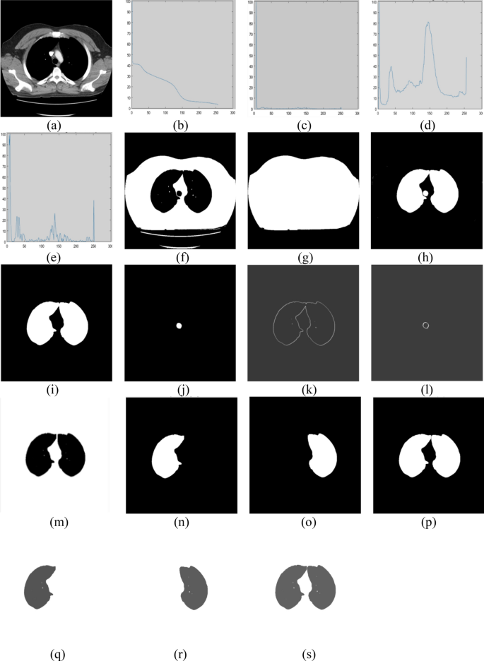 figure 22