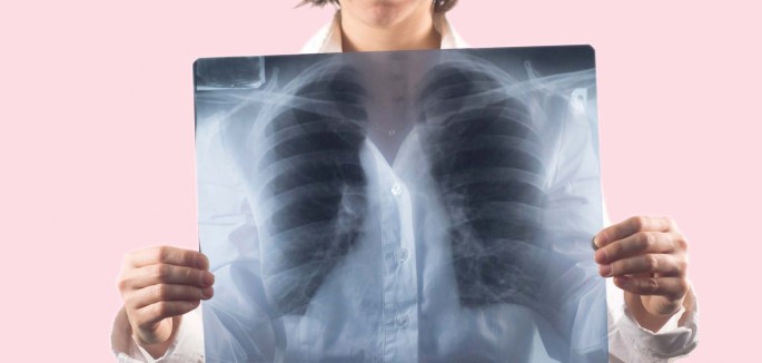 Rontgenuntersuchung Des Thorax Springerlink