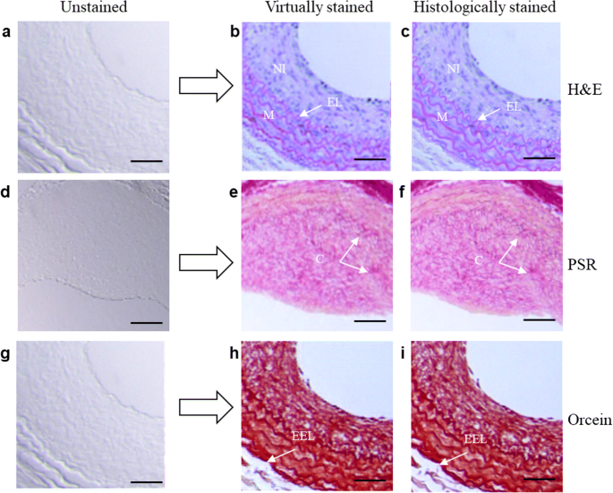 Deep Learning For Virtual Histological Staining Of Bright Field Microscopic Images Of Unlabeled Carotid Artery Tissue Springerlink
