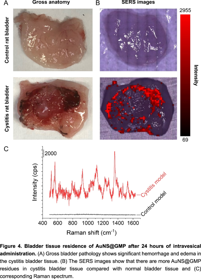 max gxl glutathione accelerator price 2023 World Molecular Imaging Congress Program | Molecular Imaging and Biology ETG Urine Tests: Detect L-glutamine Pack Size:3 Vials