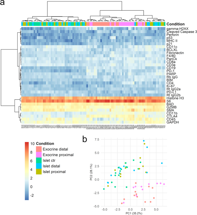 Using GeoMx DSP Spatial Proteomics to Investigate Immune Infiltration ...